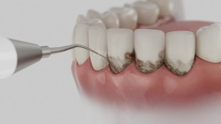 Reliable Dental contractor in Kennesaw, GA by Dentist Open Now